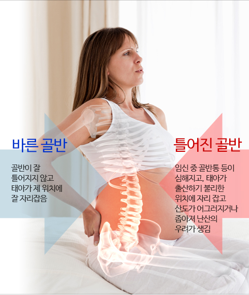 바른 골반 : 골반이 잘 틀어지지 않고 태아가 제 위치에 잘 자리 잡음. 틀어진 골반 : 임신 중 골반통 등이 심해지고, 태아가 출산하기 불리한 위치에 자리 잡고 산도가 어그러지거나 좁아져 난산의 우려가 생김